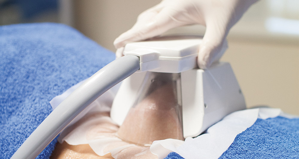 How Fat Freezing and HIFU Work Together? 2 Multiple Areas in One Session HIFU and Fat Freezing Lewes