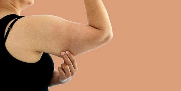 Toning Bingo Wings Lewes Effective Exercises and Tips for Achieving Sleeker Arms
