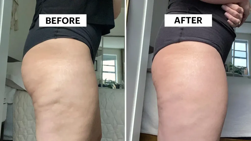 Sculpting Your Bum: Can Toning Exercises Really Reduce Cellulite? 1 Do Toning Exercise Lewes Really Tackle Cellulite?