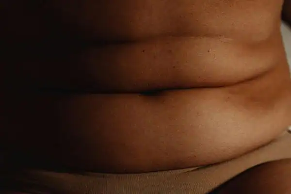The Hidden Connection: How Stress Shapes Your Fitness and Body Composition 3 image of what stress can do on the stomach area and how Lipo 360 Lewes can help to change your body shape.